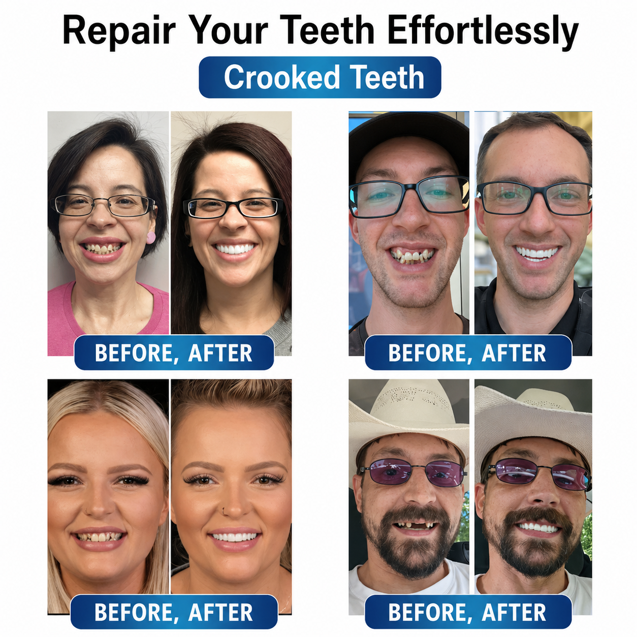 Tooth Repair Kit Moldable Gel & LED Curing