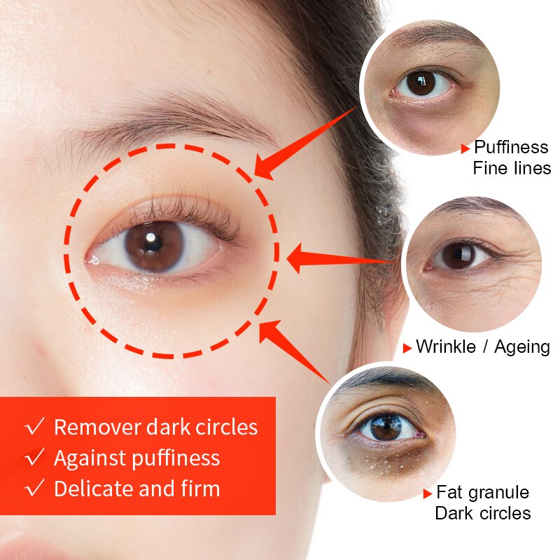 Under-Eye Cream Vitamin C & Hyaluronic Acid Dark Circle Reduction