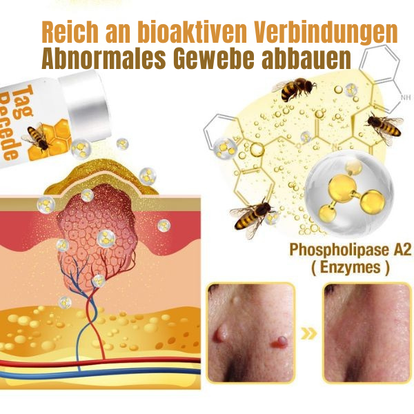 Wart Remover Spray Bee Venom-Inspired Pain-Free 20 ml