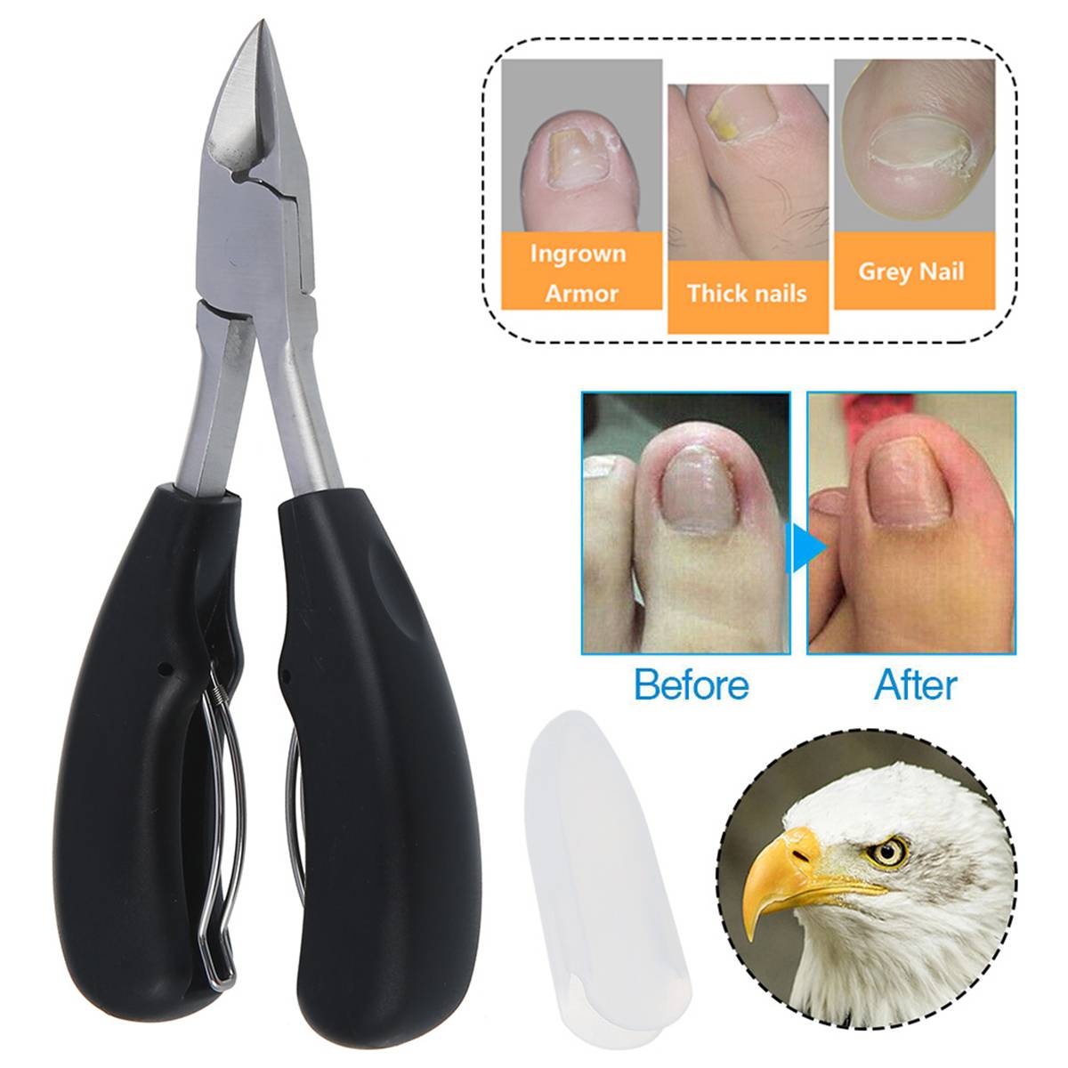 ErgoClip Nail Clippers for Resilient Nails - Set of 2