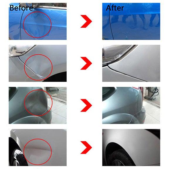 FlexiFix Adjustable Dent Remover Tool – Ultimate Car Repair Kit with 18 Glue Tabs
