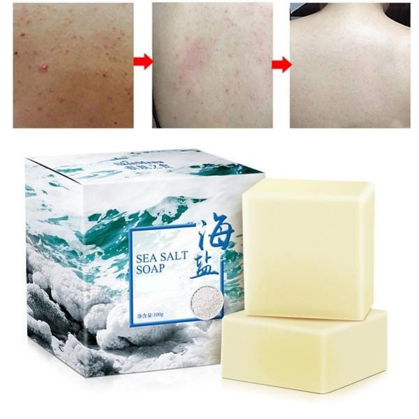 Revitalizing Sea Mineral Cleanser for Acne-Prone Skin