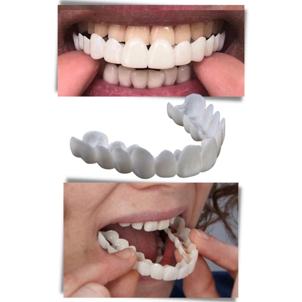 Transform Your Smile with Comfortable, Reusable Aligners