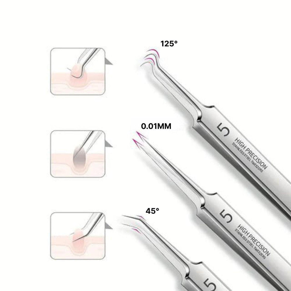 Precision Blackhead Removal Tool Set - 3-Piece Kit
