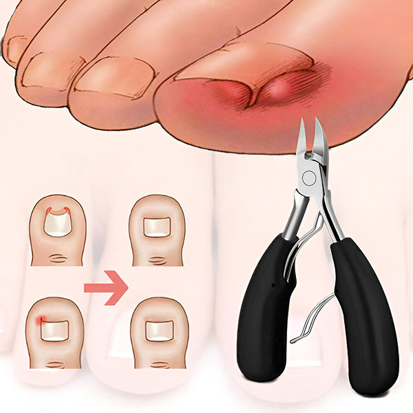 Essential Nail Grooming Set with Travel-Friendly Case