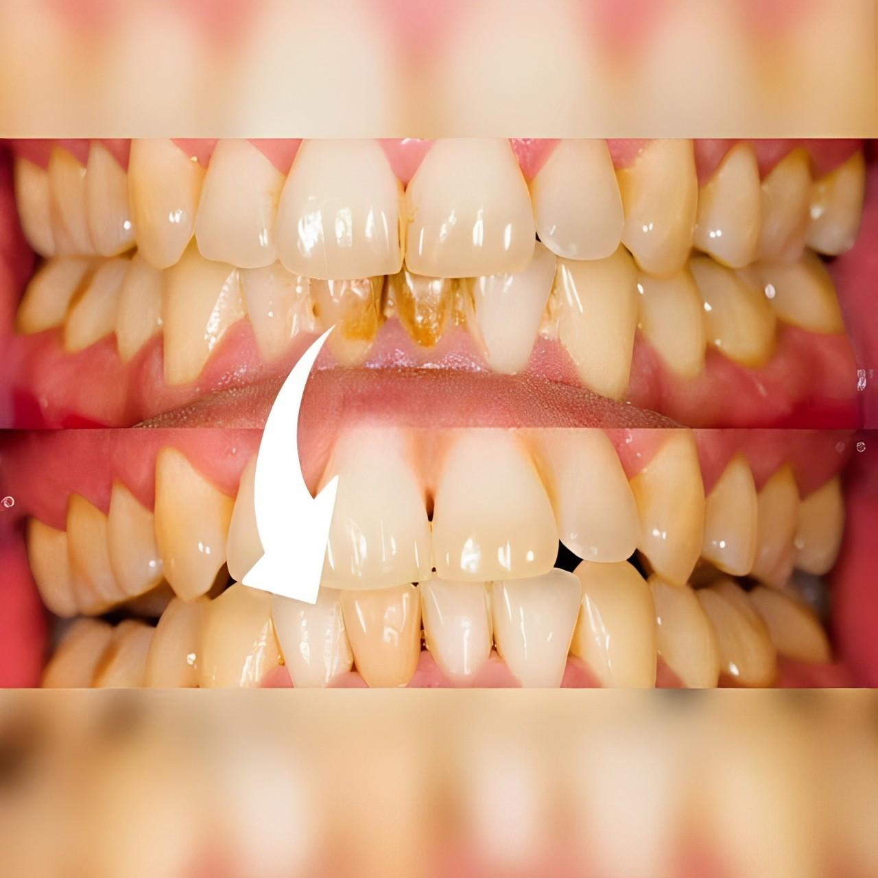 At-Home Dental Care Tool for a Bright Smile