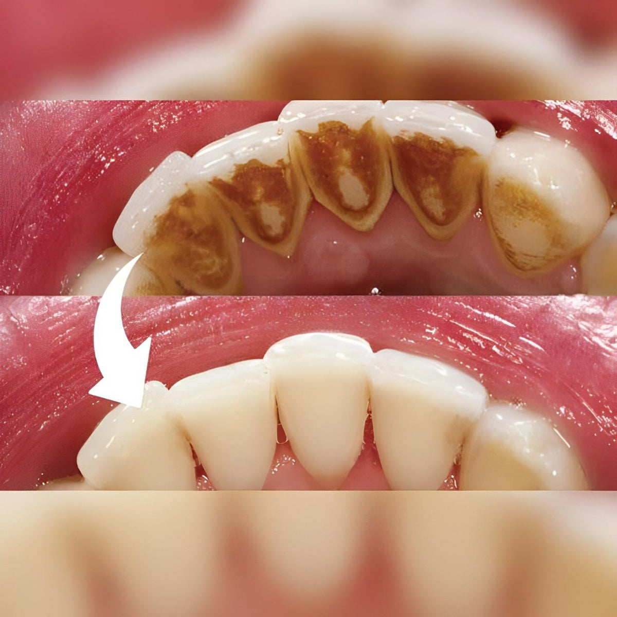 At-Home Dental Care Tool for a Bright Smile