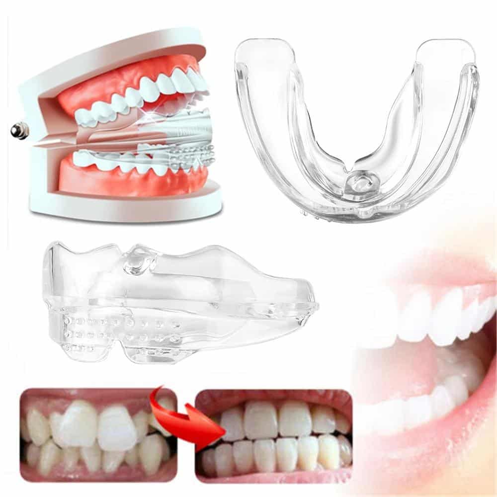 Clear Aligners for At-Home Smile Transformation