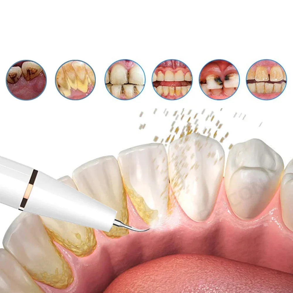 Rechargeable Ultrasonic Tooth Cleaner for Home Dental Care