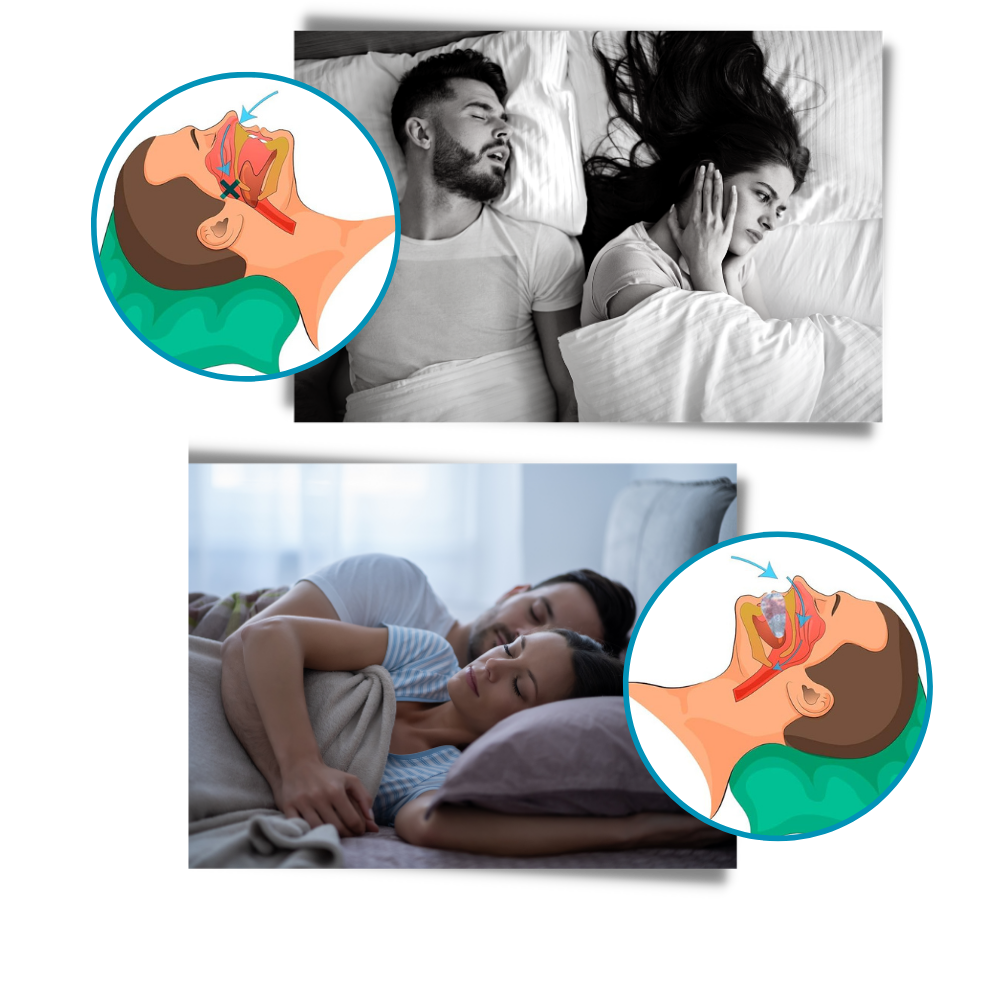 Sleep Harmony: Smart Snoring Relief Device