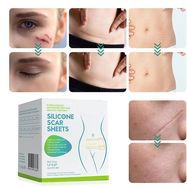 Advanced Silicone Scar Treatment Roll for Smooth Skin