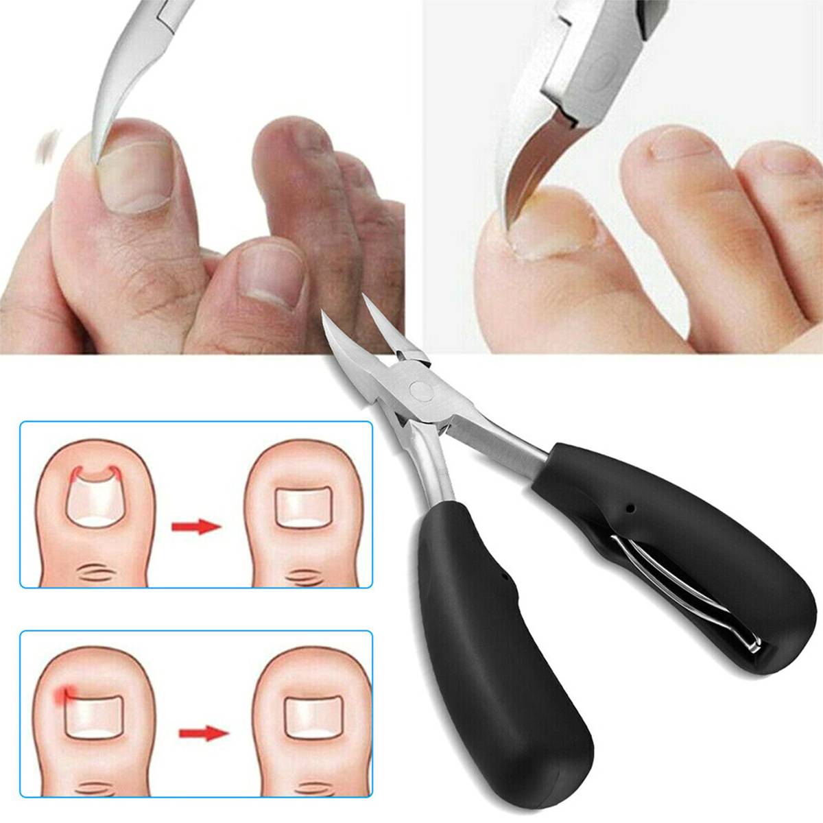 ErgoClip Nail Clippers for Resilient Nails - Set of 2
