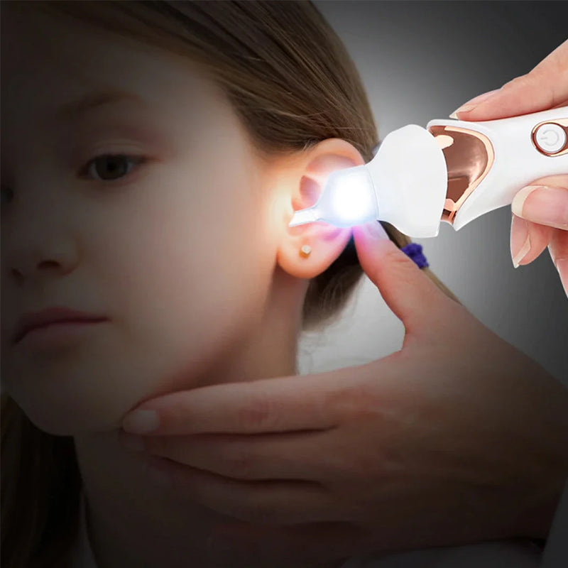 Ultimate 5-in-1 Ear Cleaning Device for Gentle Wax Removal