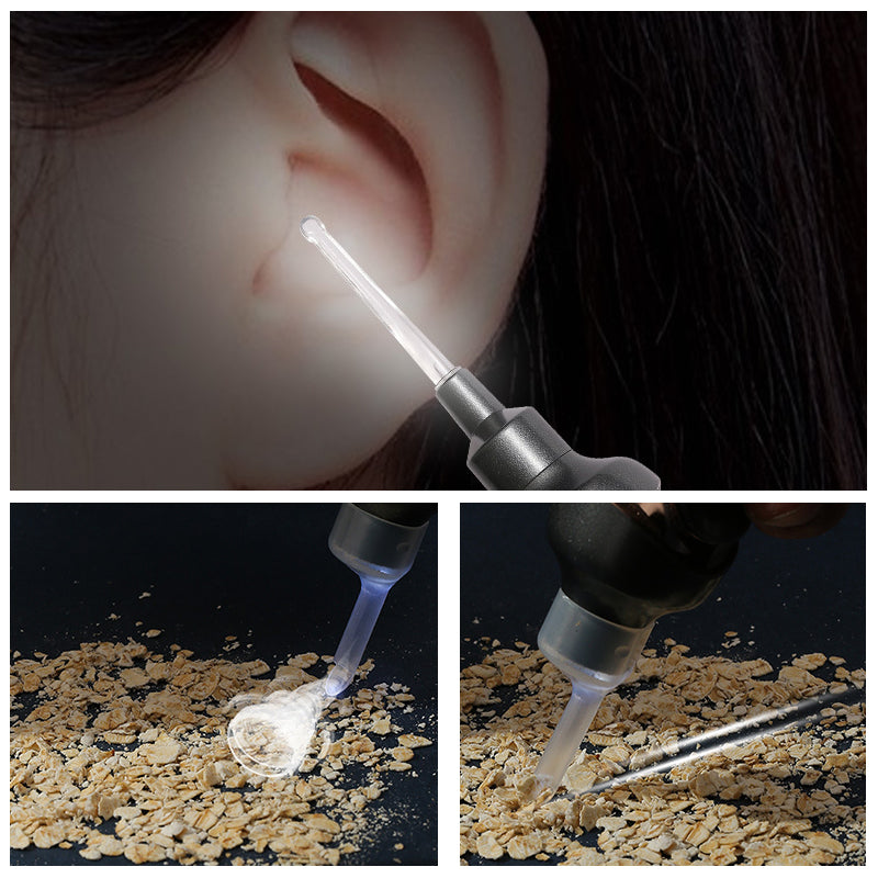 Ultimate 5-in-1 Ear Cleaning Device for Gentle Wax Removal