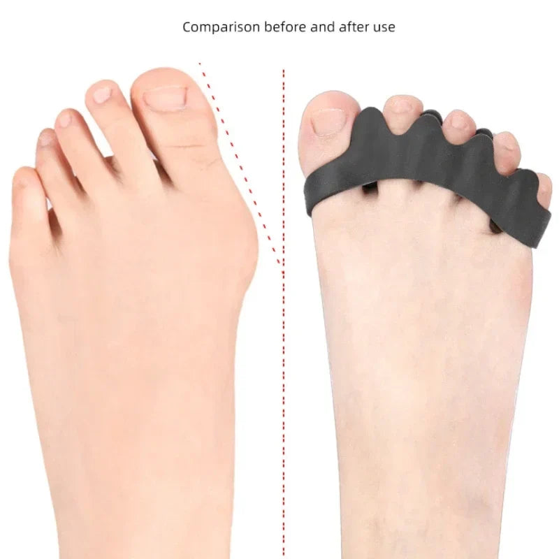 ComfortFit Silicone Toe Spacers – Soft Gel Support for Toes