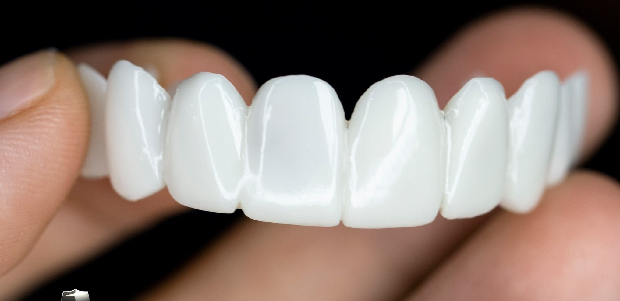 NaturalSmile | Customizable Dental Prosthesis for Everyday Confidence