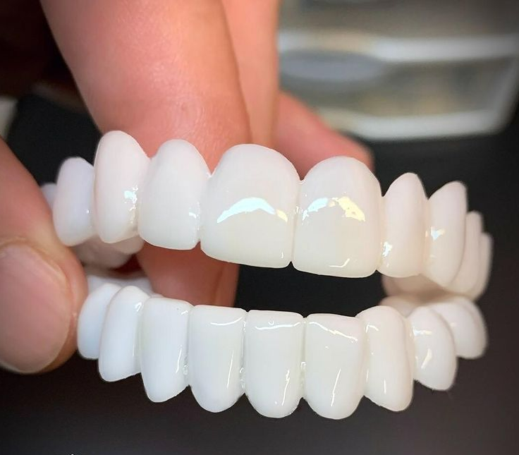 Smile Bright Dental Covers for a Confident Smile