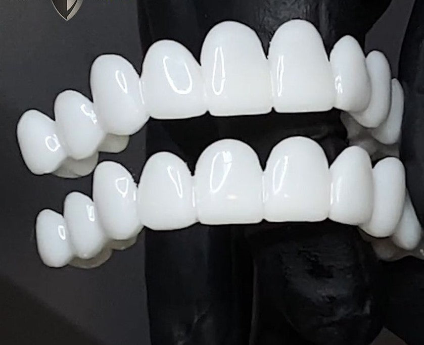 Smile Bright Dental Covers for a Confident Smile