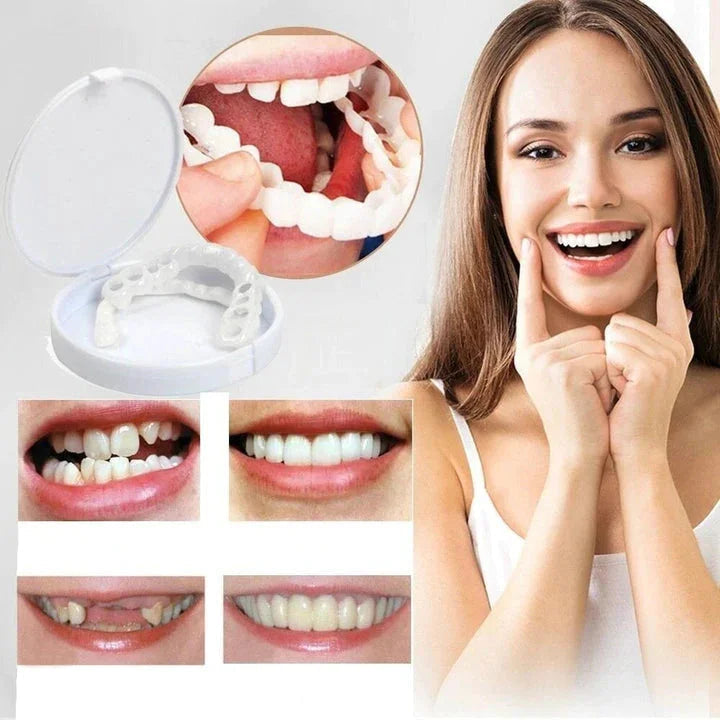 Custom Fit Smile Enhancers for Upper & Lower Teeth