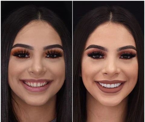 Custom Fit Smile Enhancers for Upper & Lower Teeth