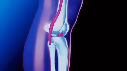 Adjustable Knee Brace for Pain Relief and Enhanced Stability