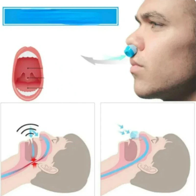 Dual-Function Snore Relief and Air Purifier Nasal Clip