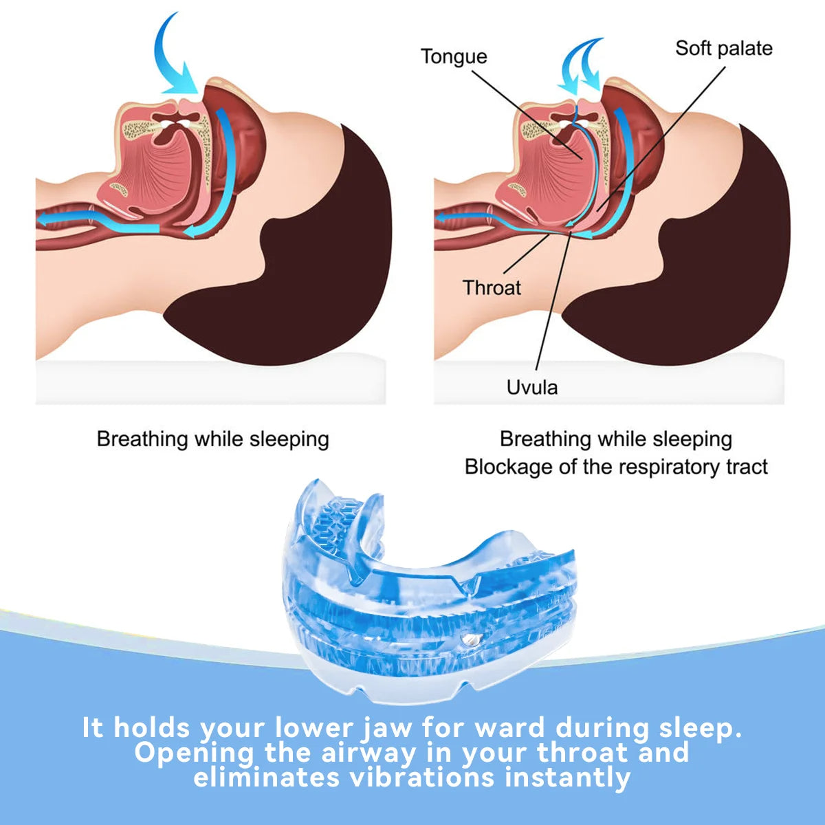 Custom Fit Anti-Snore Mouthpiece for Restful Sleep