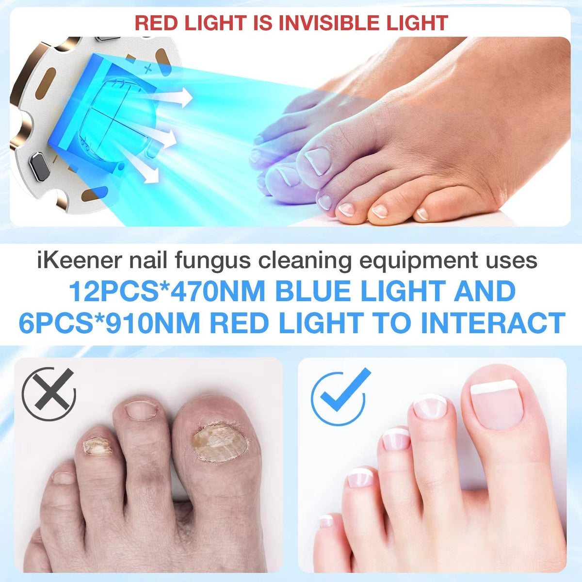 Nail Renewal Light Therapy System