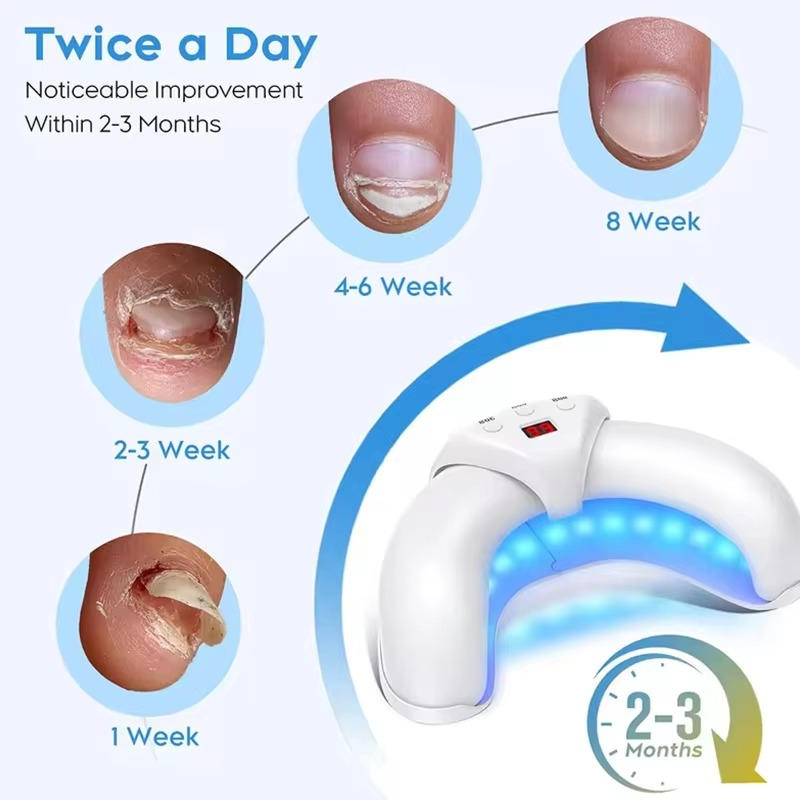 Nail Renewal Light Therapy System