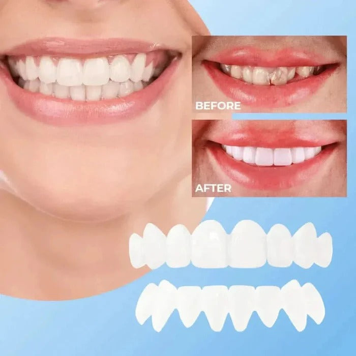 Transform Your Smile with Effortless Clip-On Veneers