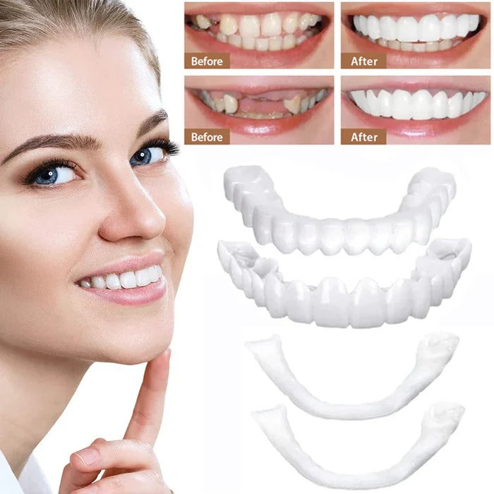 Transform Your Smile with Effortless Clip-On Veneers