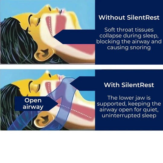 DreamGuard Sleep Chin Support Strap – Lightweight Adjustable Fit