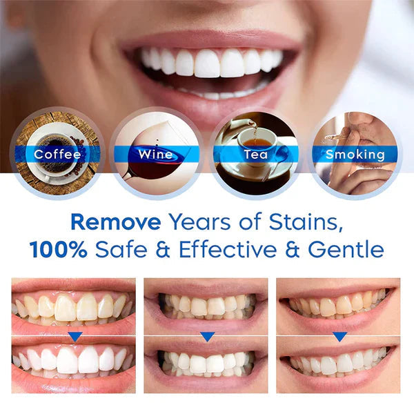 Quick & Gentle Teeth Brightening Pen