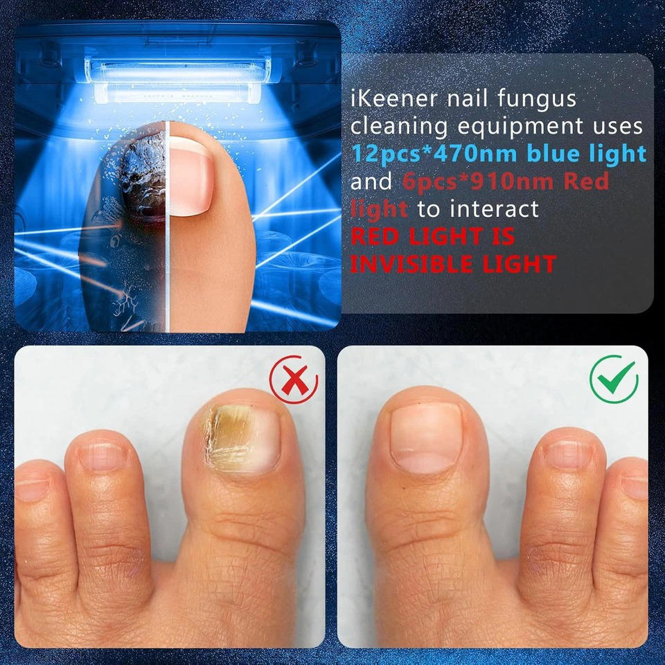 Nail Renewal Light Therapy System