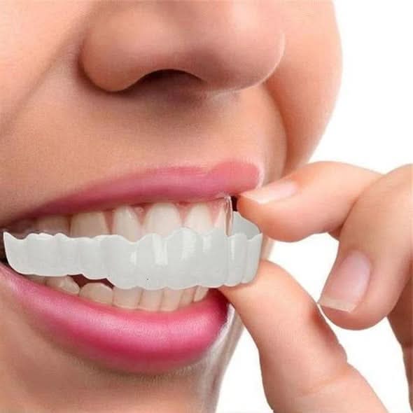 SmileBright – Complete Dual Veneer Set for Instant Confidence