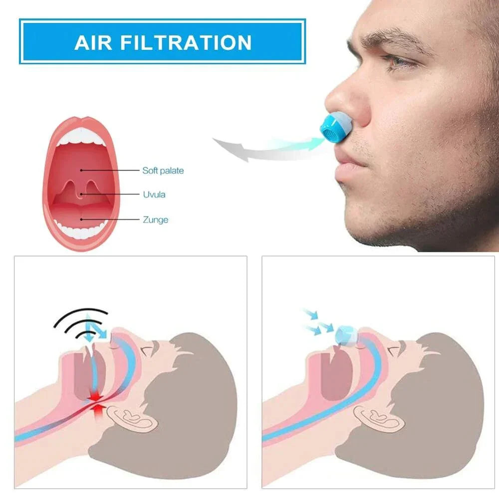 Compact Sleep Aid Device for Effortless Snoring Relief