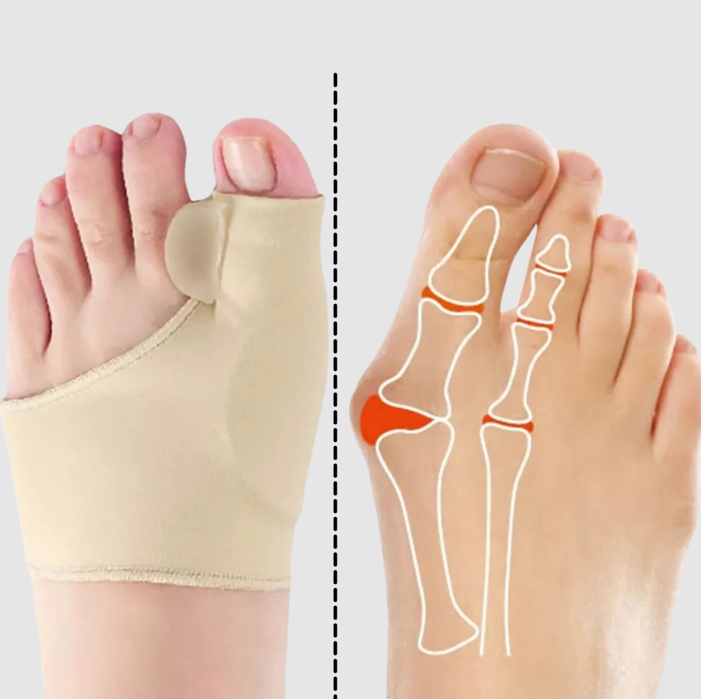 FootEase Gel Bunion Relief and Corrector
