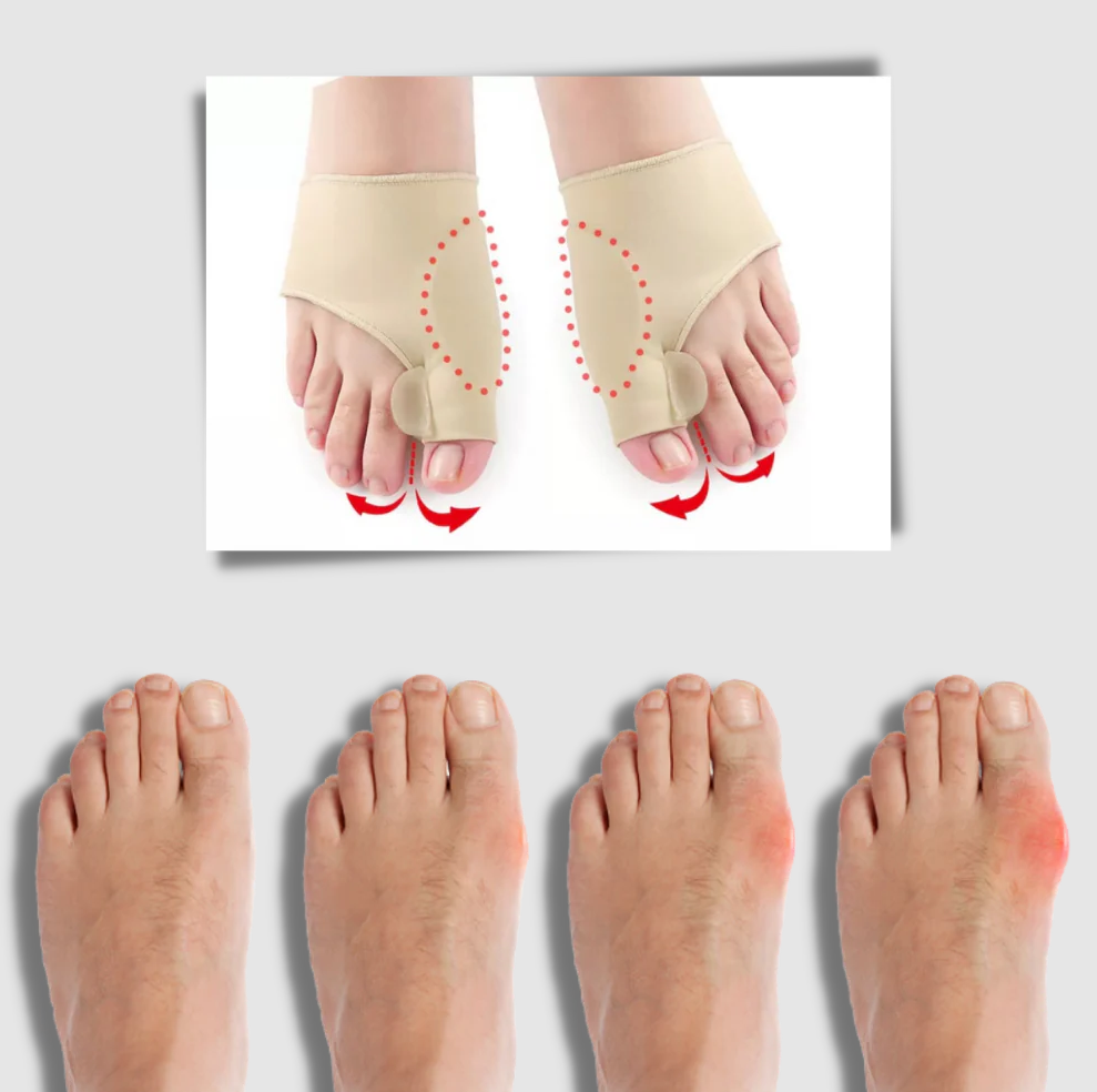 FootEase Gel Bunion Relief and Corrector