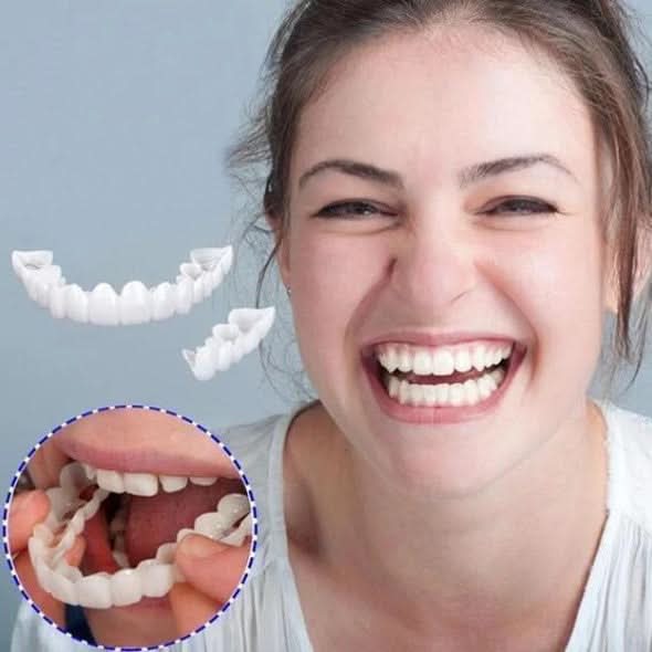SmileBright – Complete Dual Veneer Set for Instant Confidence