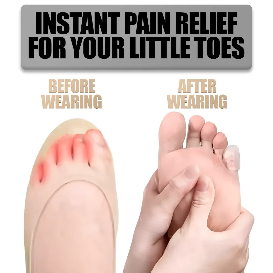 Soft Silicone Toe Shields for Ultimate Comfort