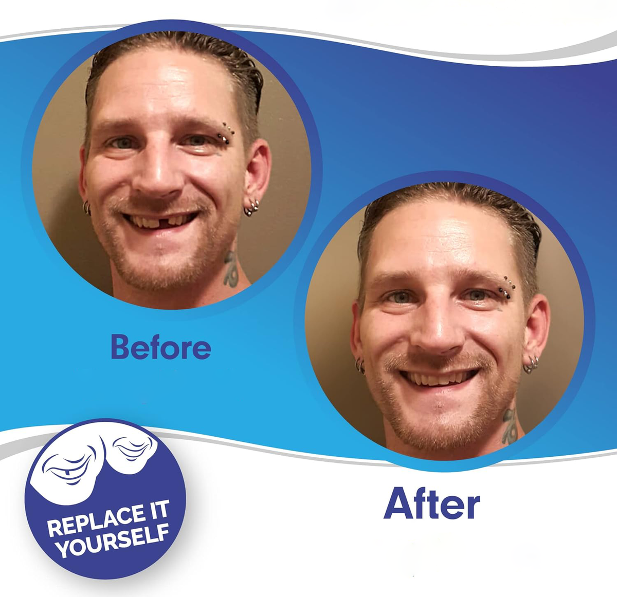 SmileSnap Clip-On Veneers – Effortless Cosmetic Teeth Cover for Instant Smile Boost
