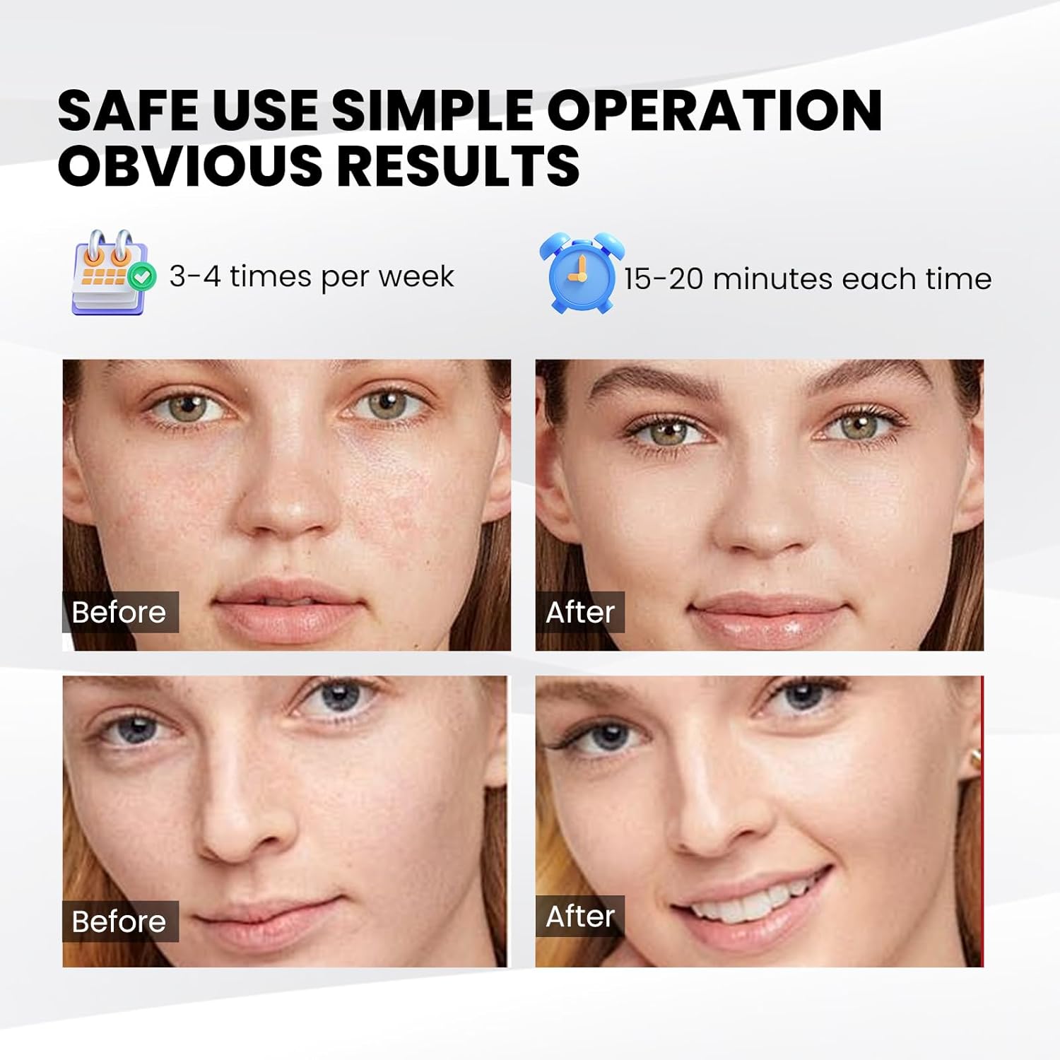 SpaGlow LED Facial Treatment Mask