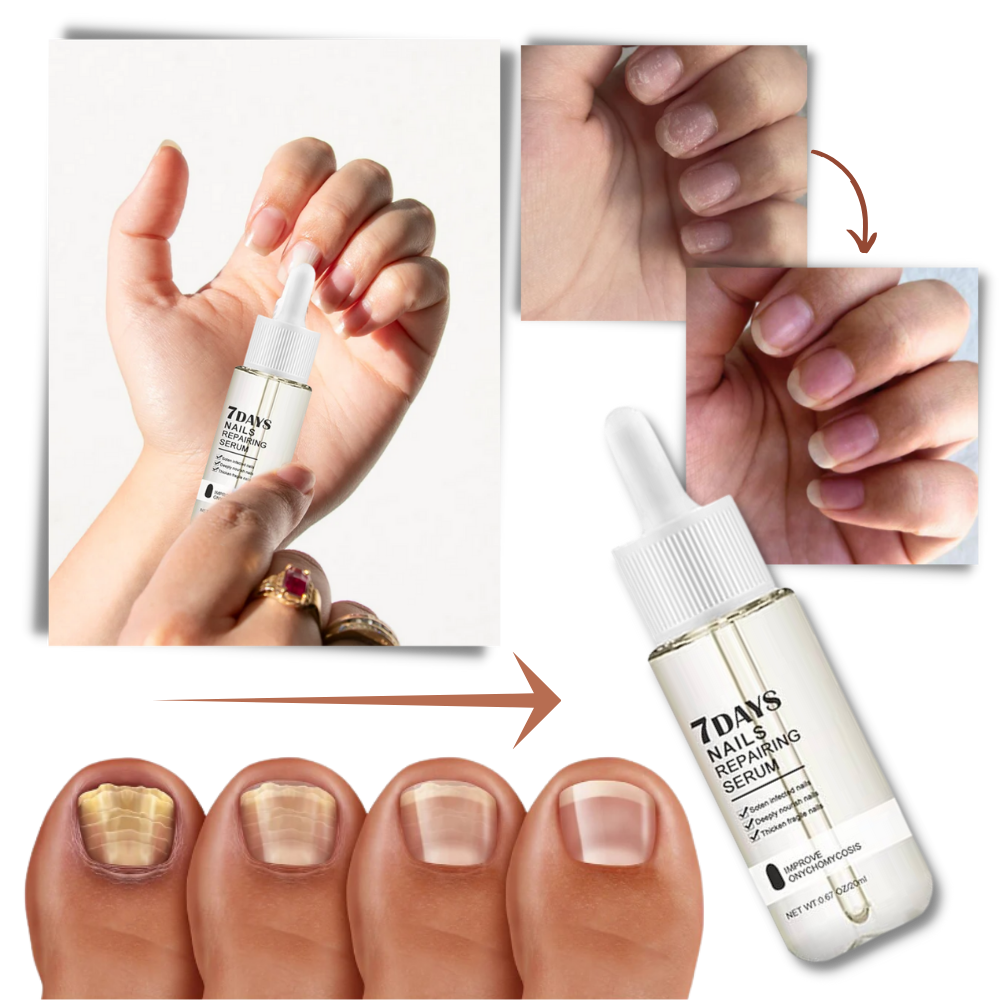 Nail Revival Serum for Stronger, Healthier Nails