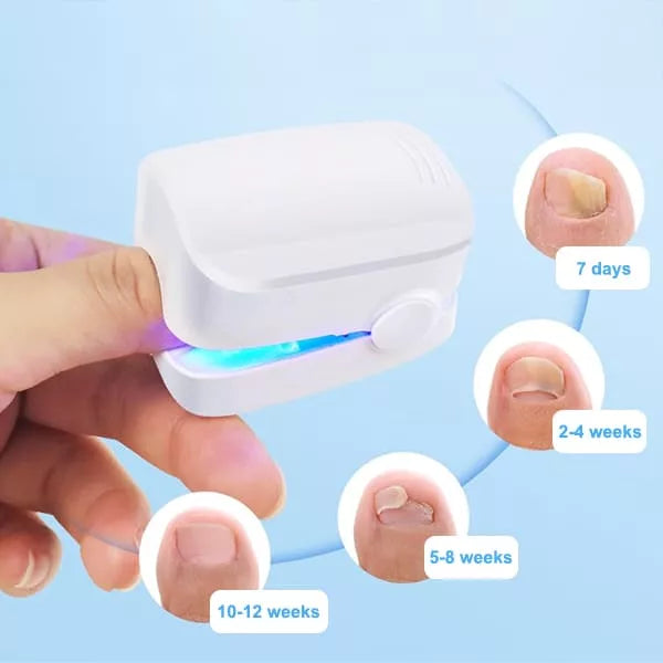 Laser Therapy Device for Healthier Nails