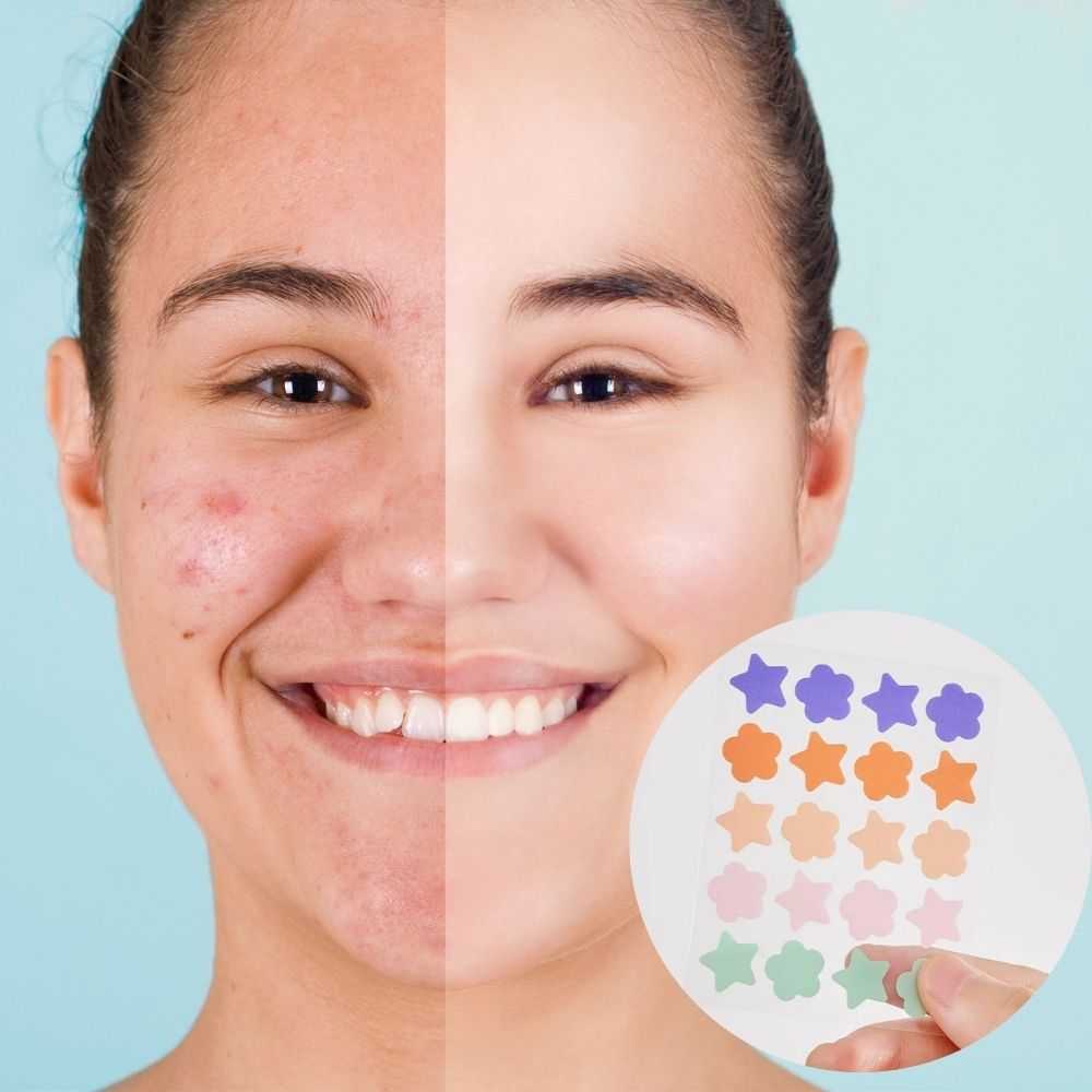 Starry Skin Repair Pimple Treatment Patches