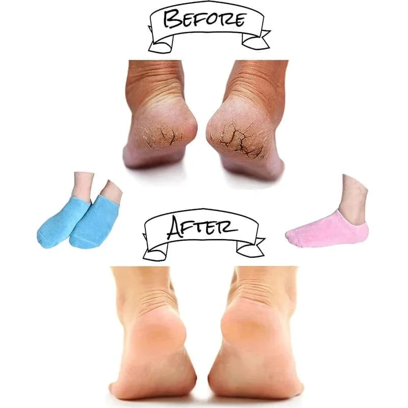 Revitalizing Foot Treatment Socks with Moisture Gel