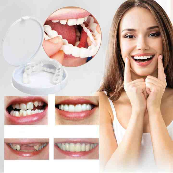 SmileEase Snap-On Teeth Covers – Adjustable, Natural-Looking Temporary Smile Enhancer