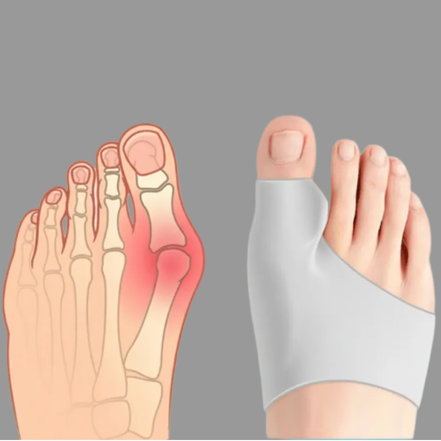 FootEase – Comfortable Hallux Valgus Support for Daily Use