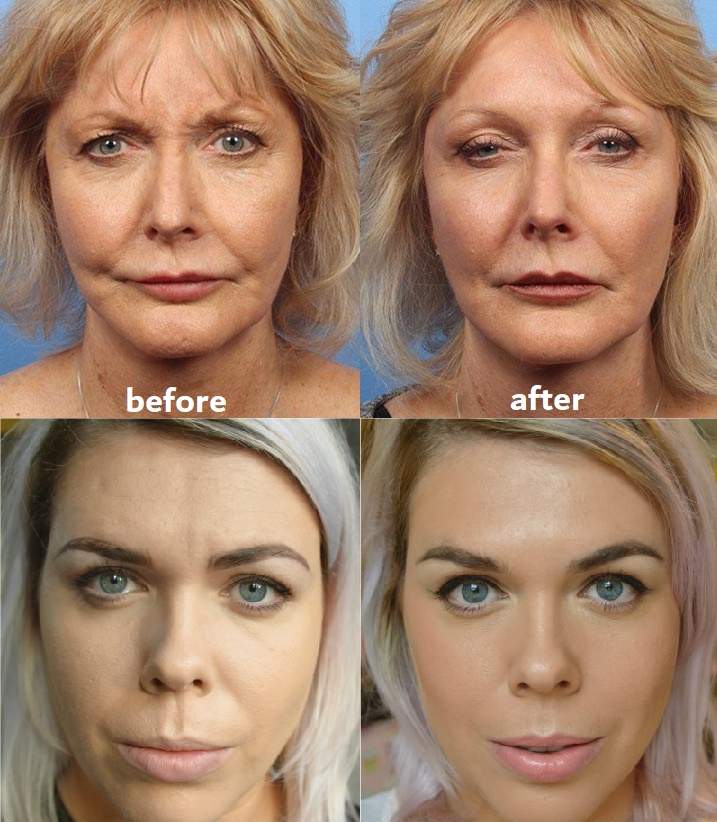 Anti-Wrinkle Pads Reusable & Hypoallergenic