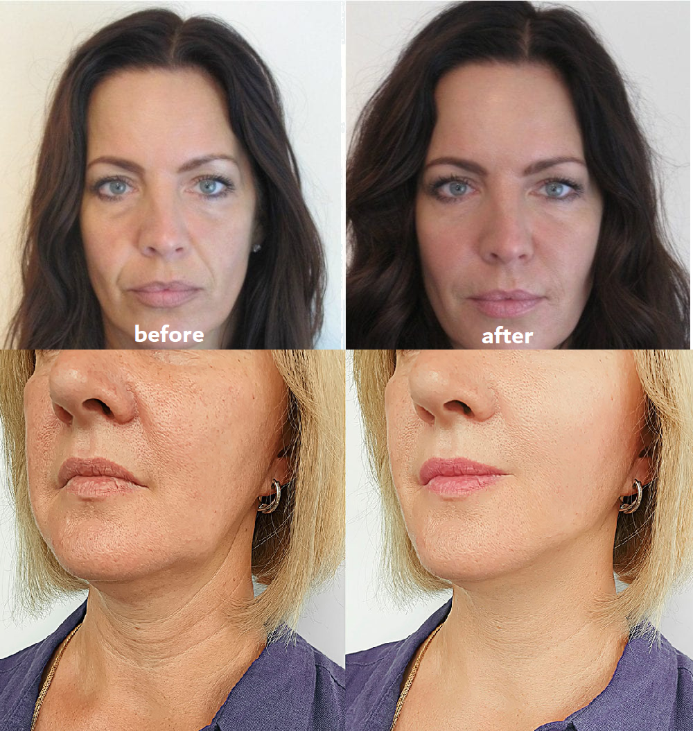 Anti-Wrinkle Pads Reusable & Hypoallergenic